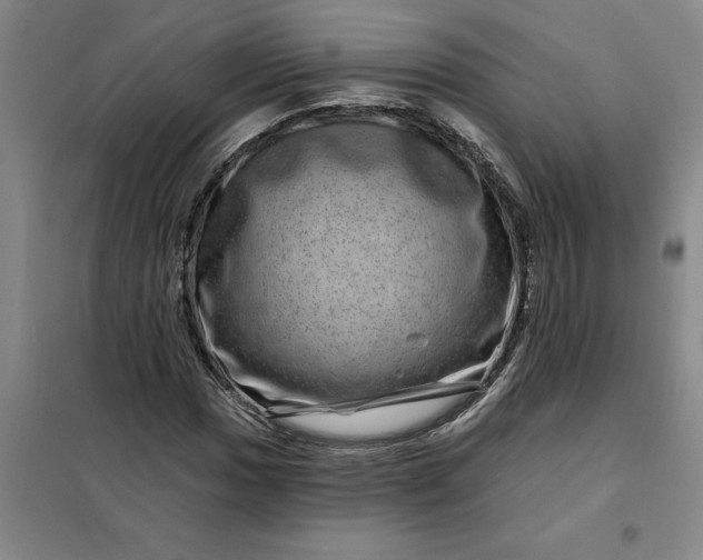 X0000098151017200805011402