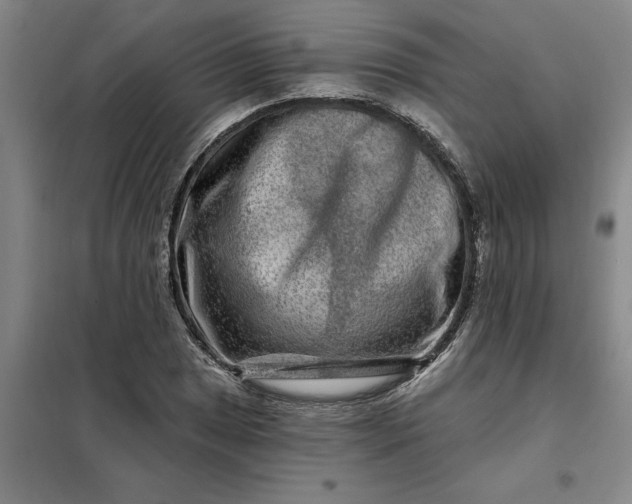 X0000098151025200805011402