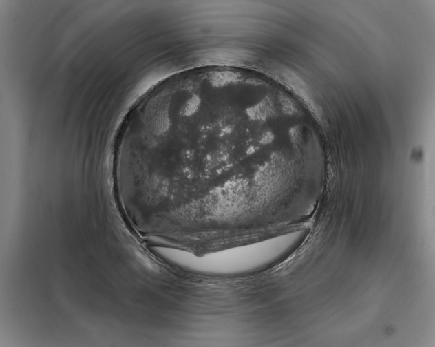 X0000098151035200805011403