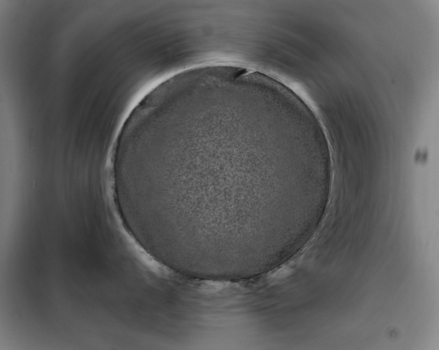 X0000098151056200805011403