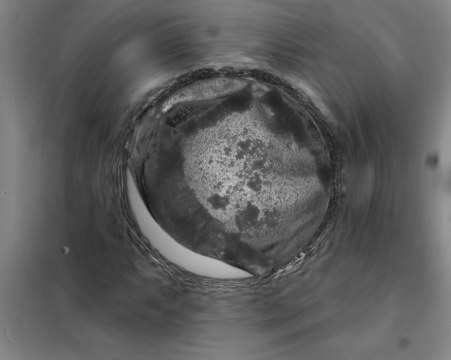 X0000098151063200805011402
