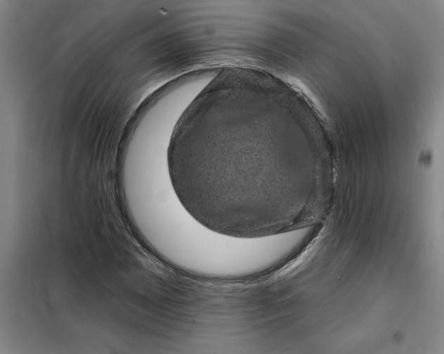 X0000098151065200805011402