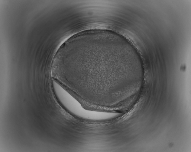 X0000098151081200805011402