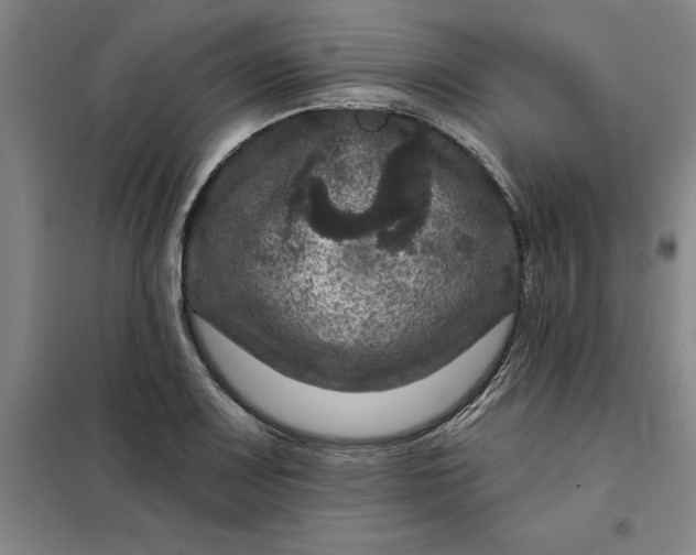 X0000098151083200805011402