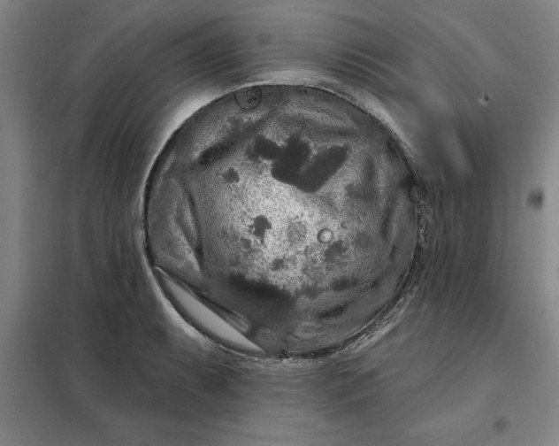 X0000098151087200805011402