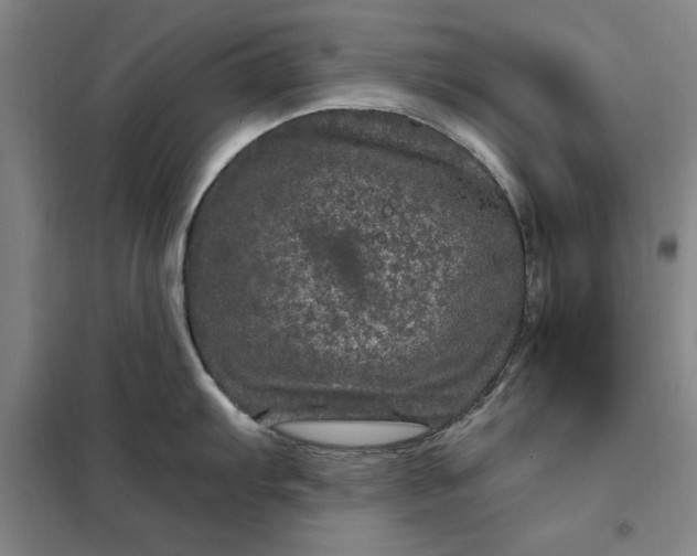 X0000098151103200805011402