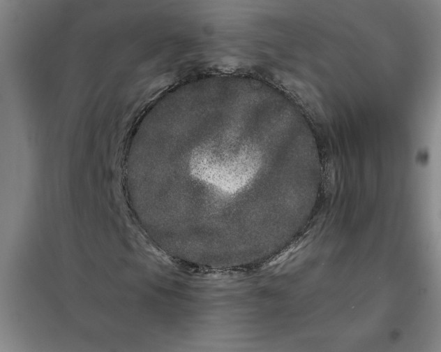 X0000098151105200805011401