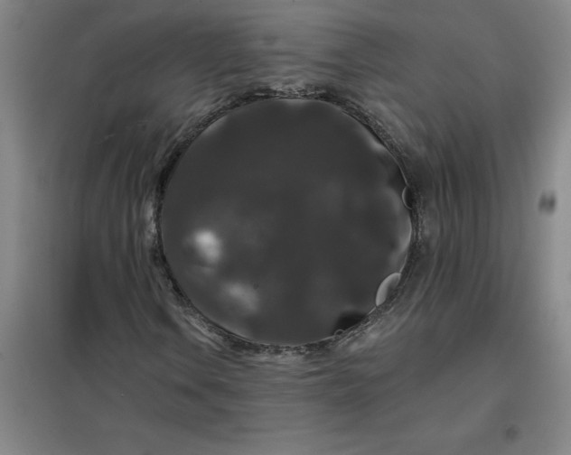 X0000098151106200805011401