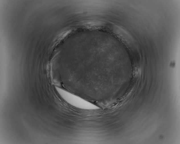 X0000098151108200805011401
