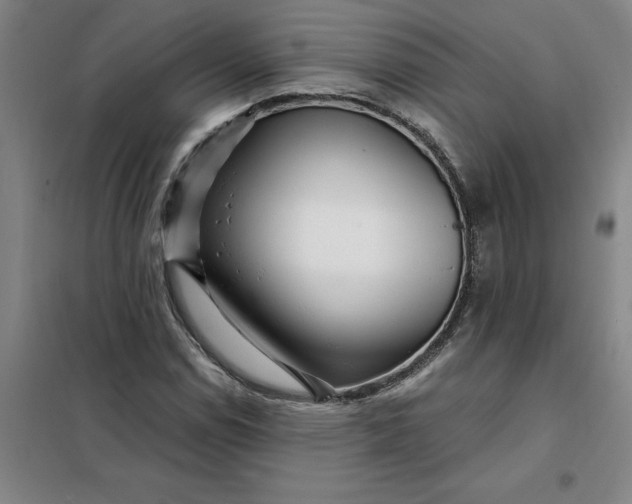 X0000098151114200805011401