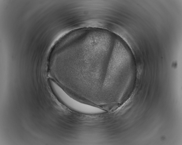 X0000098151115200805011401