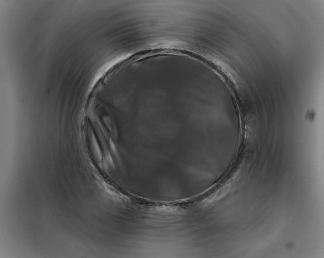 X0000098151117200805011401