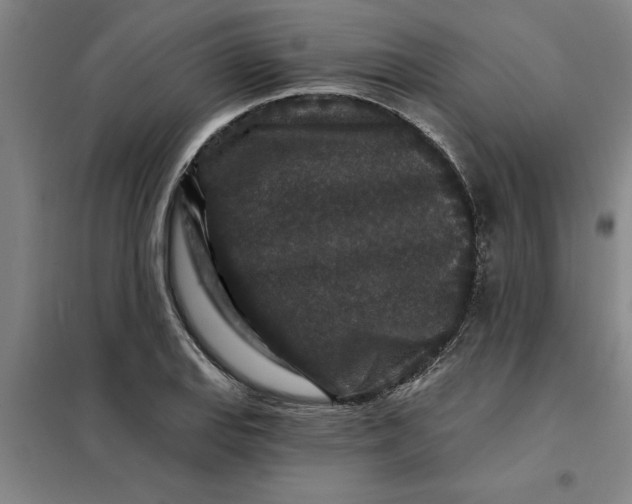 X0000098151127200805011401