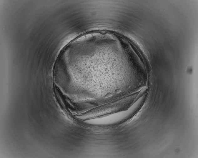 X0000098151129200805011401