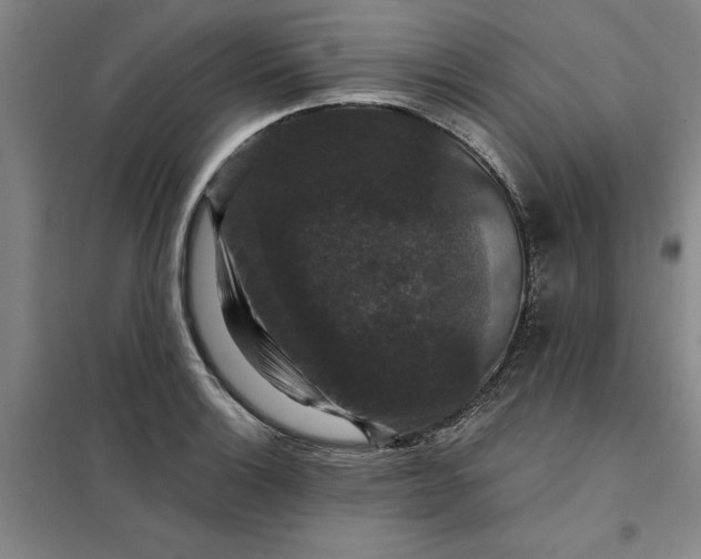 X0000098151132200805011401