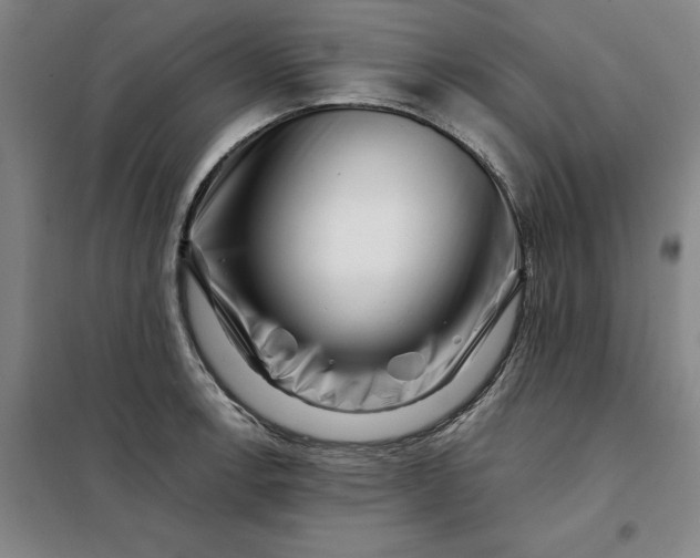 X0000098151138200805011401