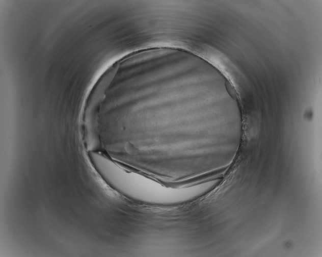 X0000098151140200805011401