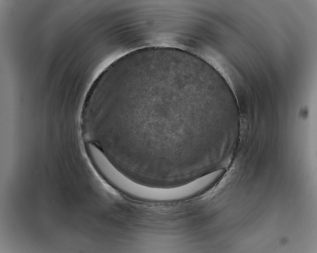 X0000098151141200805011401