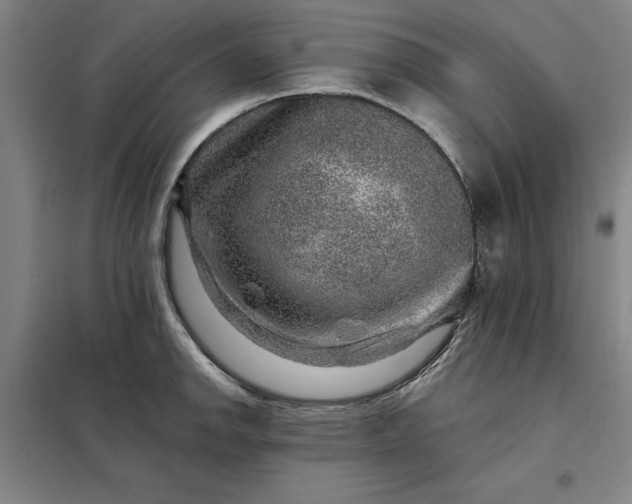 X0000098151142200805011401