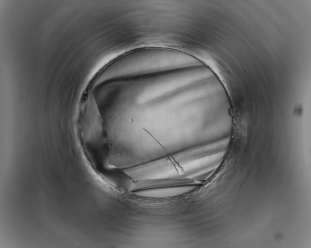X0000098151147200805011401