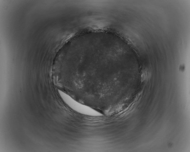 X0000098151156200805011401
