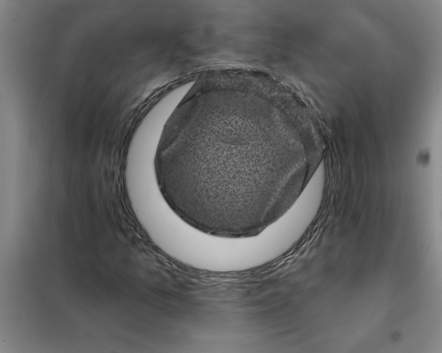 X0000098151157200805011401