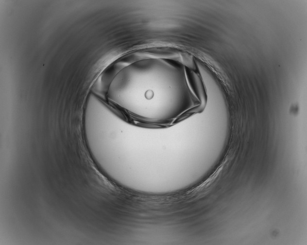X0000098151177200805011401