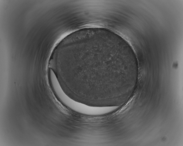X0000098151179200805011400
