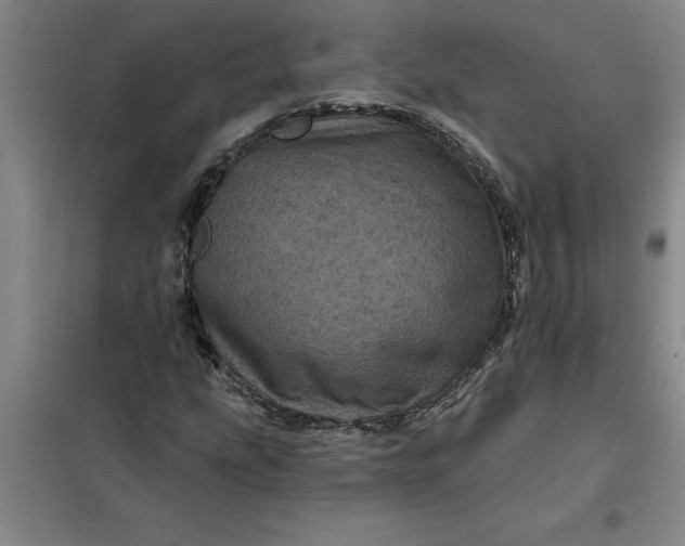 X0000098151207200805011400