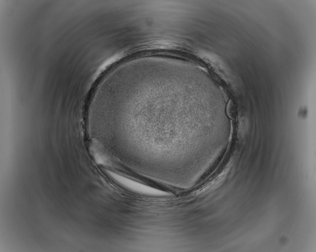 X0000098151210200805011400