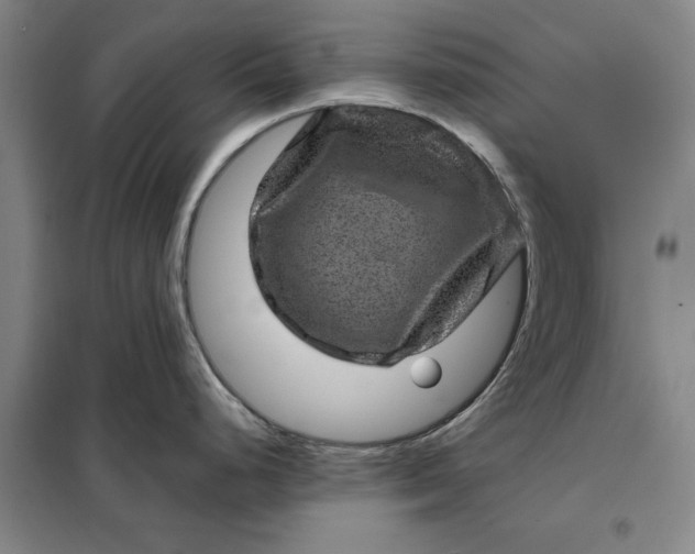 X0000098151248200805011400