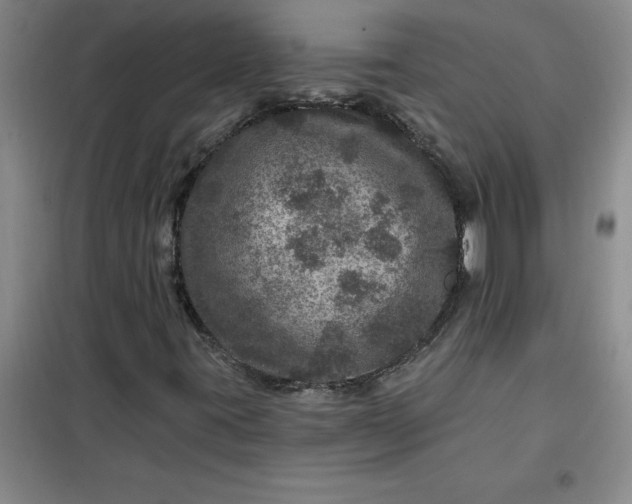 X0000098151395200805011357