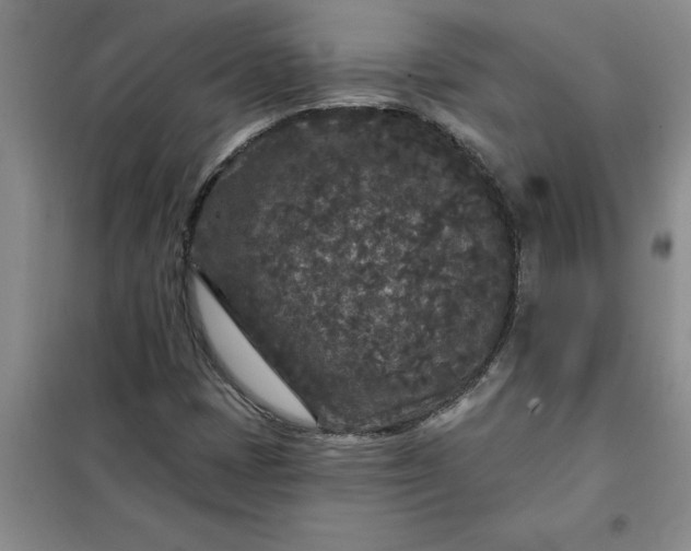 X0000098151401200805011357