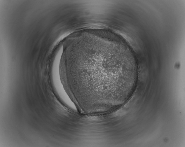 X0000098151402200805011357