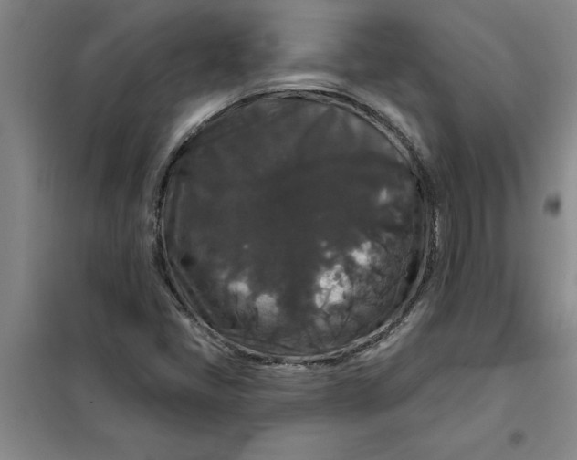 X0000098151405200805011357