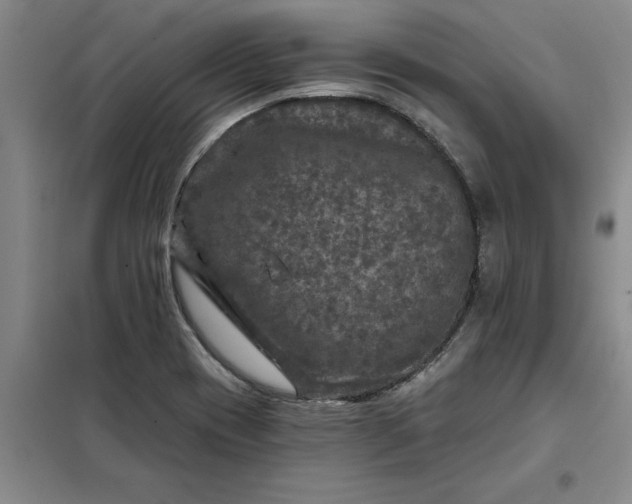 X0000098151417200805011357