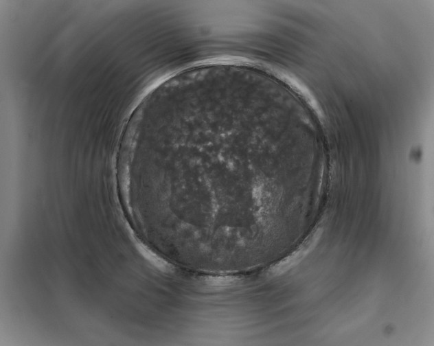 X0000098151425200805011357