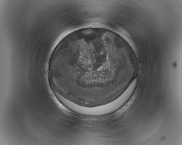 X0000098151438200805011357