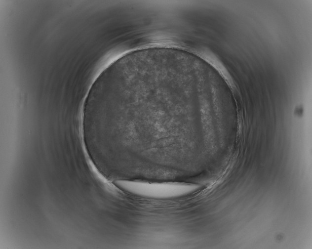 X0000098151439200805011357