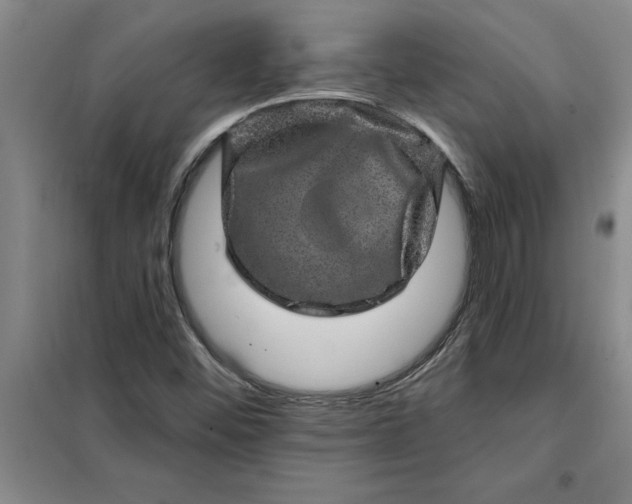 X0000098151452200805011356