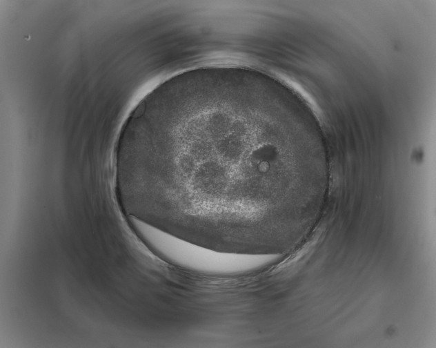 X0000098151467200805011356