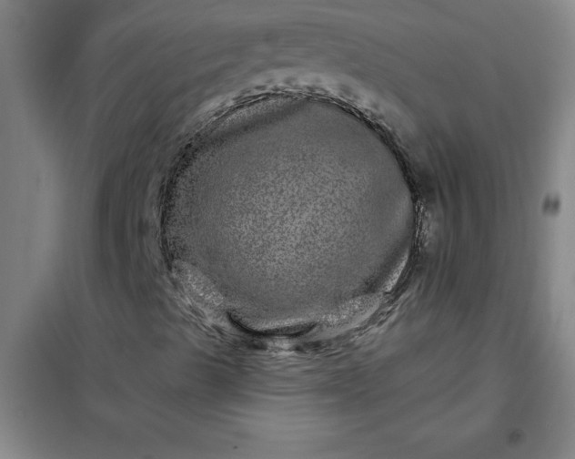 X0000098151489200805011355