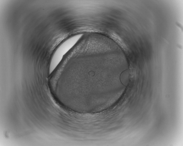 X0000098150014200805081052