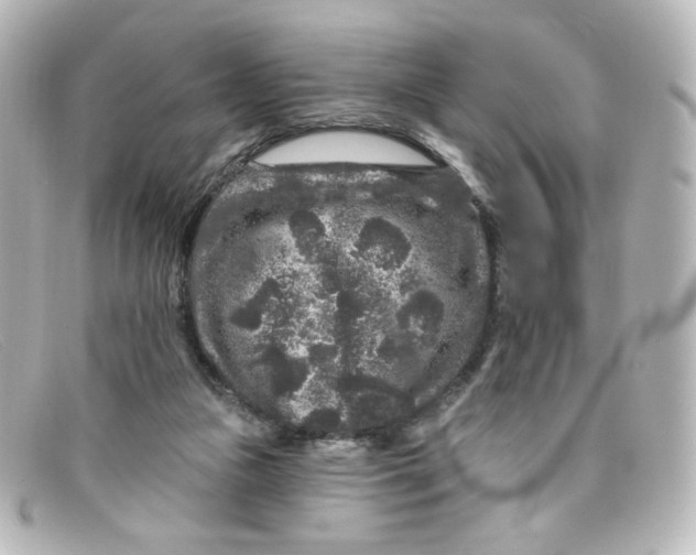 X0000098150161200805081049