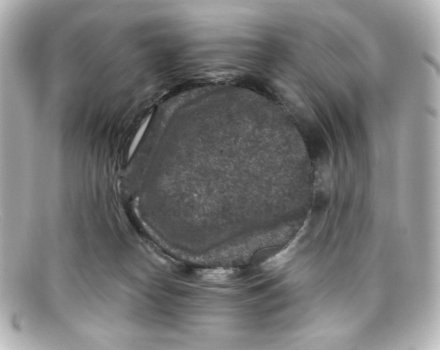 X0000098150182200805081050