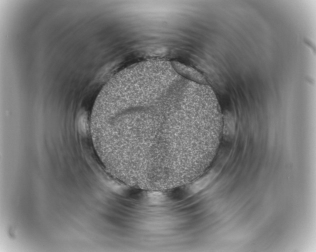 X0000098150287200805081048