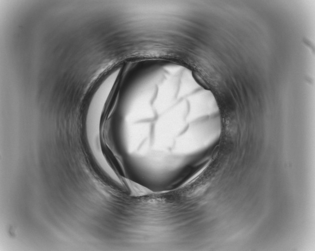 X0000098150304200805081048