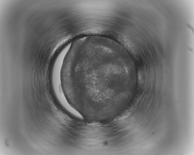 X0000098150396200805081046