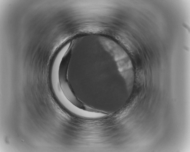 X0000098150399200805081046