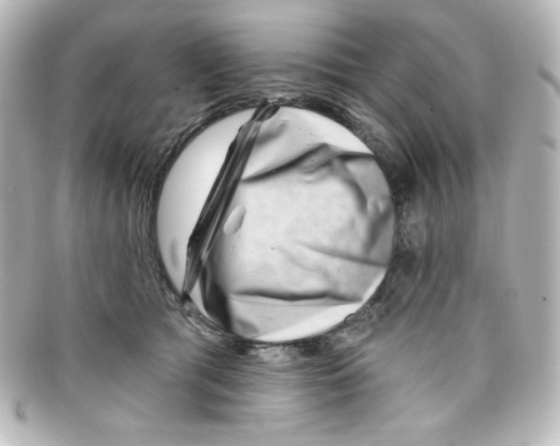 X0000098150417200805081046